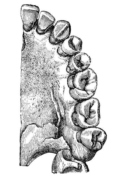 Dents