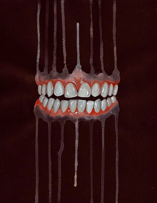 Dents